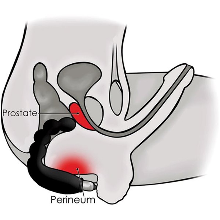 צ'יקי בוי - ויברטור אנאלי חרוזים מסיליקון לגברים