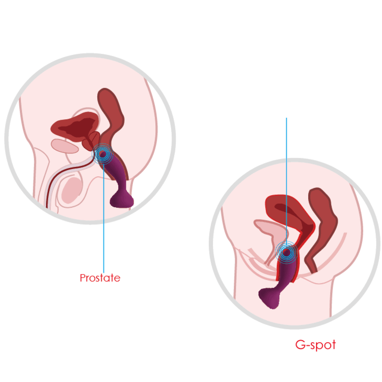 Julie - פלאג אנאלי חכם עם שלט