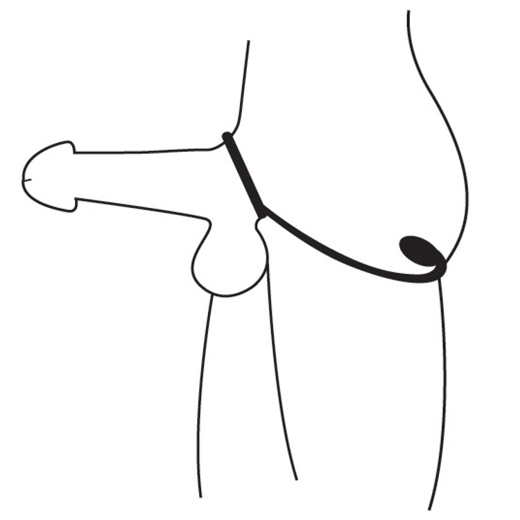 Explorer פלאג אנאלי עם קוקרינג