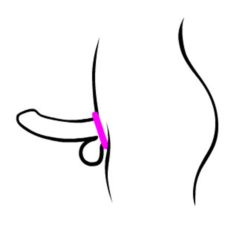 טבעת אלסטית דקה