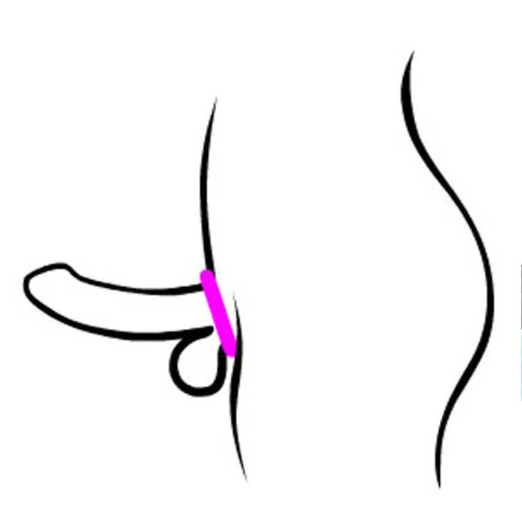 Pin Prick Cock Strap