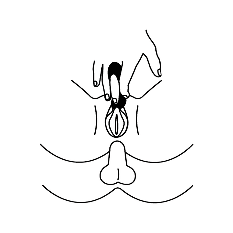 רטט זוגי רב שימושי  Candy Cane סטיספייר