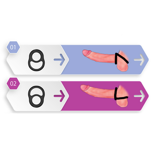 טבעת מפצלת נמתחת  Smile Ring